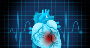 https://www.freepik.com/free-vector/human-heart-disease-symbol_27185341.htm#query=heart%20graph&position=5&from_view=search&track=sph