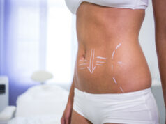 https://www.freepik.com/free-photo/female-body-with-drawing-arrows-abdomen-liposuction-cellulite-removal_8896630.htm#query=plastic%20surgery&position=27&from_view=search&track=sph