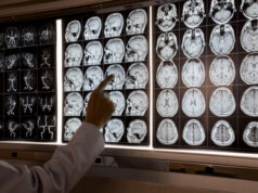 https://www.vecteezy.com/photo/10601195-doctor-pointing-at-mri-of-human-brain
