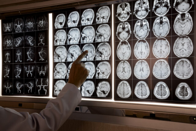 https://www.vecteezy.com/photo/10601195-doctor-pointing-at-mri-of-human-brain