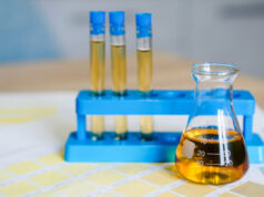 https://www.vecteezy.com/photo/3279946-flask-and-test-tubes-with-urine-on-medical-color-schemes