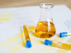 https://www.vecteezy.com/photo/3280016-flask-and-test-tubes-with-urine-on-medical-color-schemes