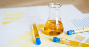 https://www.vecteezy.com/photo/3280016-flask-and-test-tubes-with-urine-on-medical-color-schemes