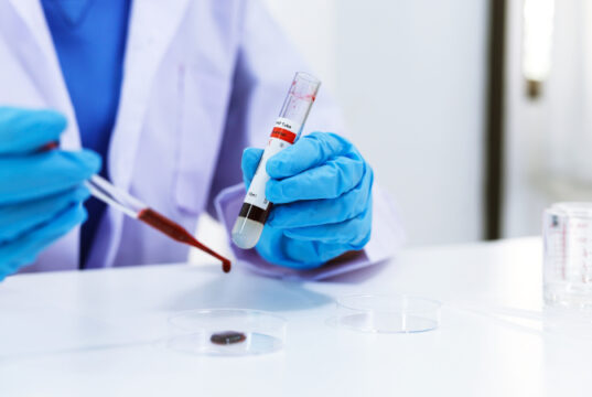 https://www.vecteezy.com/photo/1223477-scientist-is-testing-blood-sample