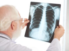 https://www.freepik.com/free-photo/checking-x-ray_5535822.htm#query=lung%20cancer&position=7&from_view=search&track=sph