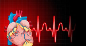 https://www.freepik.com/free-vector/heartbeat-with-heart-rate-graph_26349258.htm#query=coronary%20artery%20disease&position=24&from_view=search&track=ais