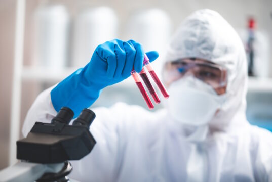 https://www.vecteezy.com/photo/2224222-researcher-holding-blood-samples