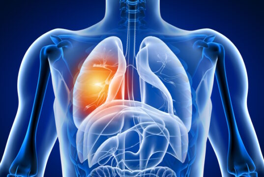 https://www.freepik.com/premium-photo/3d-illustration-human-body-with-lung-pain_6336004.htm#query=lung%20cancer&position=41&from_view=search&track=sph