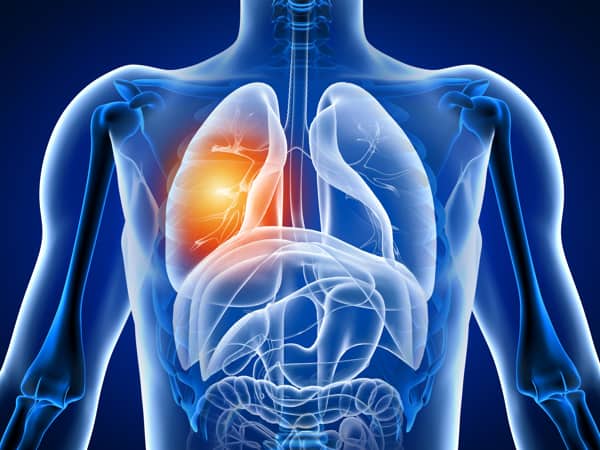https://www.freepik.com/premium-photo/3d-illustration-human-body-with-lung-pain_6336004.htm#query=lung%20cancer&position=41&from_view=search&track=sph