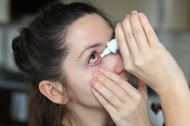 https://www.freepik.com/premium-photo/woman-dripping-her-eye-with-medicinal-drops-close-up-inflamed-brown-eyes-with-red-veins-dry-eye-syndrome_27202910.htm#query=dry%20eyes&position=40&from_view=search&track=ais