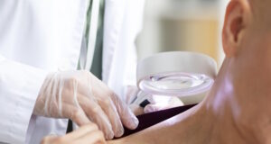 https://www.freepik.com/free-photo/doctor-doing-check-patient-with-skin-cancer_14831352.htm#query=melanoma&position=0&from_view=search&track=sph