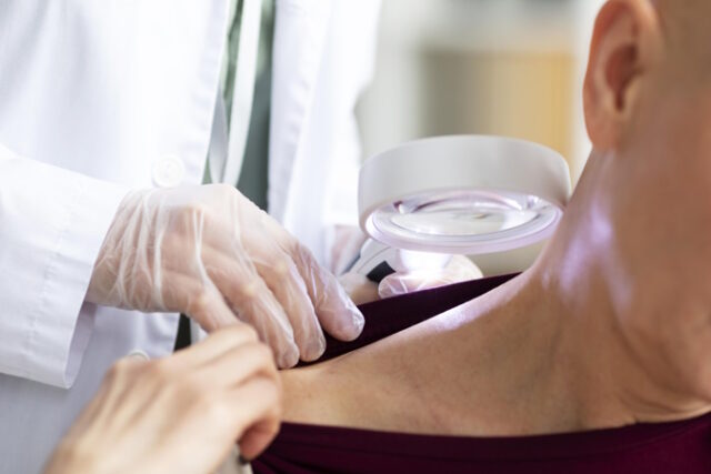 doctor-doing-check-patient-with-skin-cancer https://www.freepik.com/free-photo/doctor-doing-check-patient-with-skin-cancer_14831352.htm#query=melanoma&position=0&from_view=search&track=sph