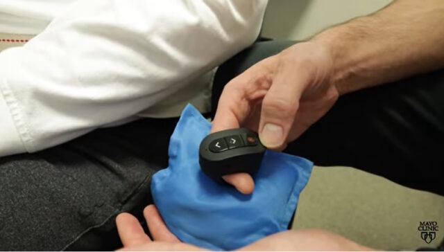 Vagus Nerve Stimulation