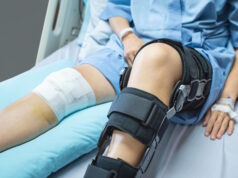 https://www.freepik.com/premium-photo/asian-woman-patient-with-bandage-compression-knee-brace-support-injury-bed-nursing-hospital-healthcare-medical-support_7421845.htm#query=injured&position=25&from_view=search&track=sph
