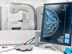 https://www.freepik.com/premium-photo/mammogram-snapshot-breasts-female-patient-monitor_13949432.htm#query=mammogram&position=15&from_view=search&track=sph