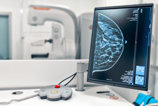 https://www.freepik.com/premium-photo/mammogram-snapshot-breasts-female-patient-monitor_13949432.htm#query=mammogram&position=15&from_view=search&track=sph