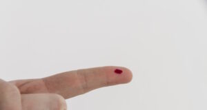 https://www.freepik.com/free-photo/bleeding-finger_1093208.htm#query=finger%20prick&position=6&from_view=search&track=ais