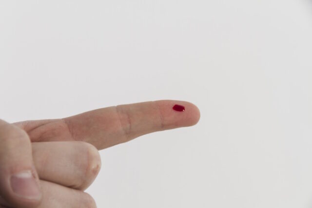 bleeding-finger https://www.freepik.com/free-photo/bleeding-finger_1093208.htm#query=finger%20prick&position=6&from_view=search&track=ais