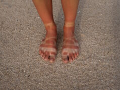 https://www.freepik.com/free-photo/view-woman-s-sunburn-feet-from-wearing-sandals-beach_40165584.htm#page=2&query=sunburn&position=5&from_view=search&track=sph