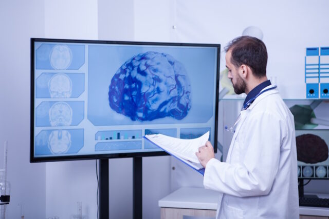 Doctor checking the brain analyzes of a patient on his clipboard https://www.freepik.com/premium-photo/doctor-checking-brain-analyzes-patient-his-clipboard-specialist-doctor-brain-healthcare_22847809.htm#query=doctor%20brain&position=6&from_view=search&track=ais