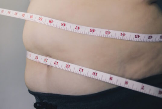 https://www.vecteezy.com/photo/3334460-human-body-and-fat-body-paunch-or-belly-and-overweight-of-people