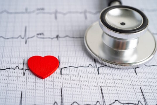 https://www.vecteezy.com/photo/6425236-stethoscope-on-electrocardiogram-ecg-with-red-heart-heart-wave-heart-attack-cardiogram-report
