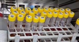 https://www.vecteezy.com/photo/22749997-test-tubes-with-blood-samples-in-the-incubator-during-the-process-of-preparation-for-karyotype-and-fluorescence-in-situ-hybridization-fish-in-the-laboratory