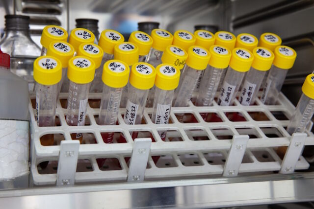 https://www.vecteezy.com/photo/22749997-test-tubes-with-blood-samples-in-the-incubator-during-the-process-of-preparation-for-karyotype-and-fluorescence-in-situ-hybridization-fish-in-the-laboratory