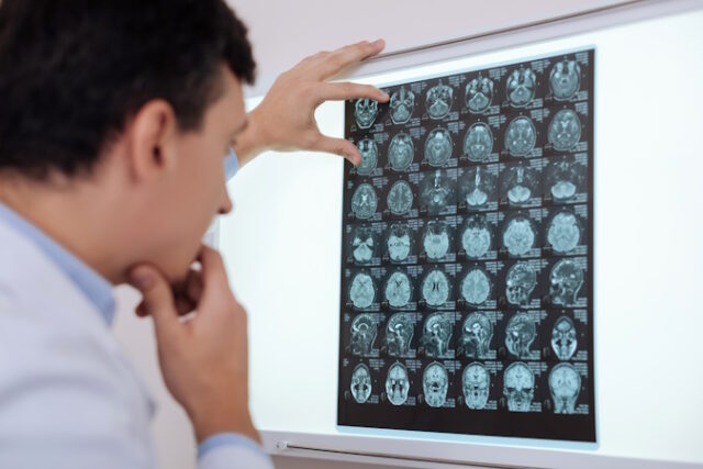 Serious thoughtful radiologist looking for a brain pathology https://www.freepik.com/premium-photo/diagnostic-research-serious-thoughtful-experienced-radiologist-holding-x-ray-photo-looking-brain-pathology-while-putting-diagnosis_12719774.htm#&position=13&from_view=search&track=ais&uuid=eeab4276-b50d-43e7-9a99-5a5c4931db42