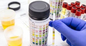 https://www.freepik.com/premium-photo/urine-test-made-with-vial-urinalysis-reagent-strip-used-ketosis-control-laboratory-examination_25310022.htm#&position=39&from_view=search&track=ais&uuid=c757ce8d-da65-4761-ac3d-1990232db686