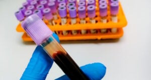 https://www.vecteezy.com/photo/34138277-technologist-holding-levender-or-whole-blood-edta-tube-with-blood-sample-for-medical-testing-in-laboratory