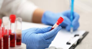 https://www.freepik.com/premium-photo/scientist-working-with-blood-sample-laboratory_45005202.htm#query=blood%20lab&position=43&from_view=search&track=ais&uuid=788aa40b-9e51-468f-9b58-7898a17653c1