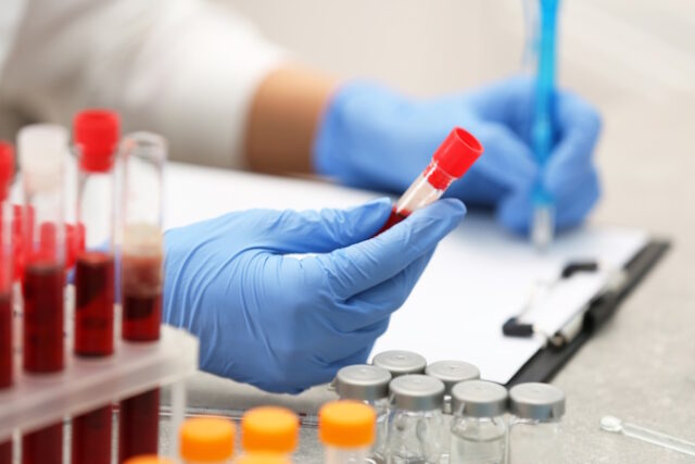 https://www.freepik.com/premium-photo/scientist-working-with-blood-sample-laboratory_45005202.htm#query=blood%20lab&position=43&from_view=search&track=ais&uuid=788aa40b-9e51-468f-9b58-7898a17653c1