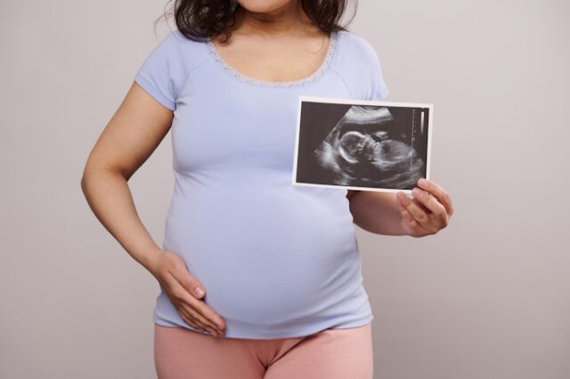 https://www.vecteezy.com/photo/23731196-cropped-view-pregnant-woman-caressing-her-belly-showing-at-camera-the-newborn-baby-ultrasound-scan-over-white-backdrop