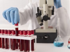 Blood test, Alzheimer's, https://www.freepik.com/free-photo/coronavirus-blood-samples-arrangement-lab_18684532.htm#fromView=search&page=1&position=15&uuid=c98c8d47-5db9-4099-a7e0-ccff6d81098a