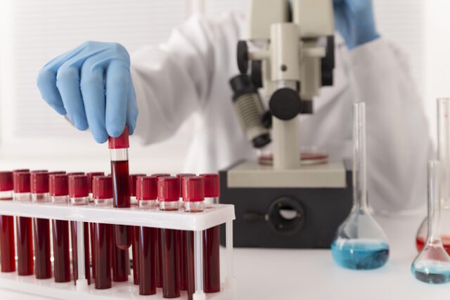 coronavirus-blood-samples-arrangement-lab Blood test, Alzheimer's, https://www.freepik.com/free-photo/coronavirus-blood-samples-arrangement-lab_18684532.htm#fromView=search&page=1&position=15&uuid=c98c8d47-5db9-4099-a7e0-ccff6d81098a