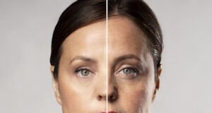 https://www.freepik.com/free-photo/before-after-portrait-mature-woman-retouched_18962235.htm#fromView=search&page=1&position=6&uuid=0dd907f6-14ac-446c-8755-7345d19552c7