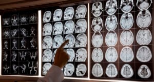 https://www.vecteezy.com/photo/10601195-doctor-pointing-at-mri-of-human-brain