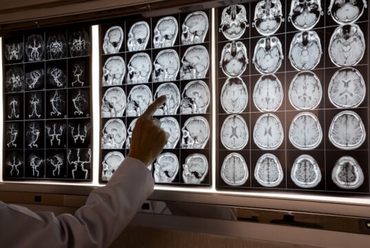 https://www.vecteezy.com/photo/10601195-doctor-pointing-at-mri-of-human-brain