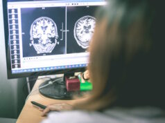 Brain MRI Photo 105514090 © Atthapon Raksthaput | Dreamstime.com