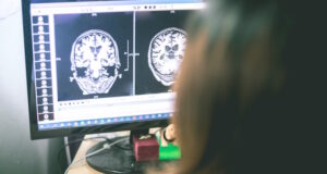 Brain MRI Photo 105514090 © Atthapon Raksthaput | Dreamstime.com