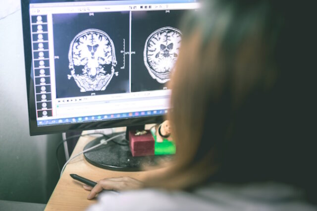 dreamstime_s_105514090 Brain MRI Photo 105514090 © Atthapon Raksthaput | Dreamstime.com