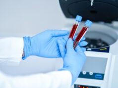 https://www.vecteezy.com/photo/15895000-test-tube-with-blood-and-mixing-machine