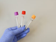 https://www.vecteezy.com/photo/14749040-nurse-holding-blood-test-tube-with-result-coronavirus-test-2019-ncov-virus-diagnostic-labs