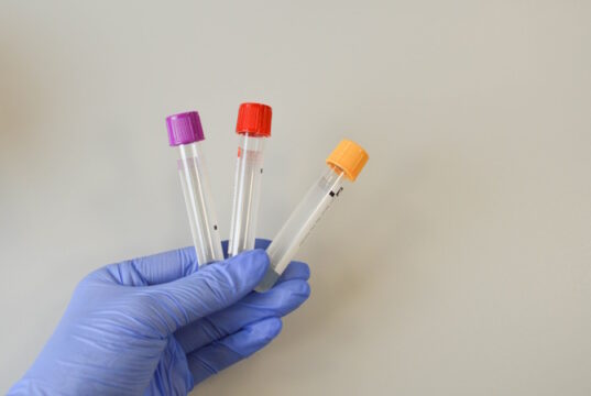 https://www.vecteezy.com/photo/14749040-nurse-holding-blood-test-tube-with-result-coronavirus-test-2019-ncov-virus-diagnostic-labs