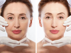 facial fillers ID 162769975 © Oleksandra Lysenko | Dreamstime.com