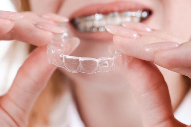 https://www.vecteezy.com/photo/31153902-dental-care-smiling-girl-with-braces-on-her-teeth-holds-aligners-in-her-hands-and-shows-the-difference-between-them