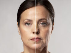https://www.freepik.com/free-photo/before-after-portrait-mature-woman-retouched_18962235.htm#fromView=search&page=1&position=12&uuid=b2a4552c-0e76-4646-ae7e-2db8a247e24b&query=face+lift