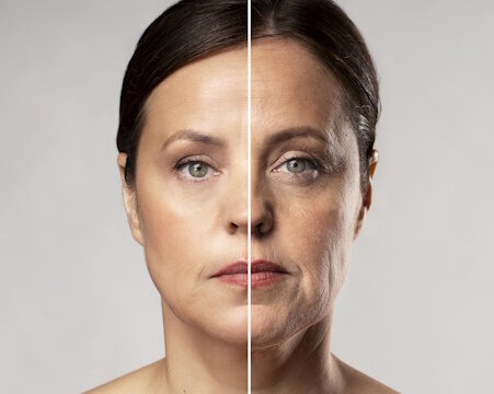 https://www.freepik.com/free-photo/before-after-portrait-mature-woman-retouched_18962235.htm#fromView=search&page=1&position=12&uuid=b2a4552c-0e76-4646-ae7e-2db8a247e24b&query=face+lift