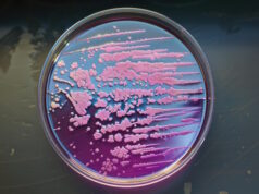 https://www.vecteezy.com/photo/55359190-pink-bacteria-growing-on-agar-plate-in-microbiology-lab